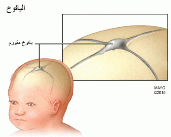 أعراض مرض الأعصاب في الرأس