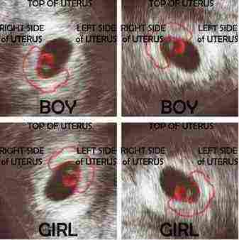 كيفية معرفة نوع الجنين من الشهر الاول