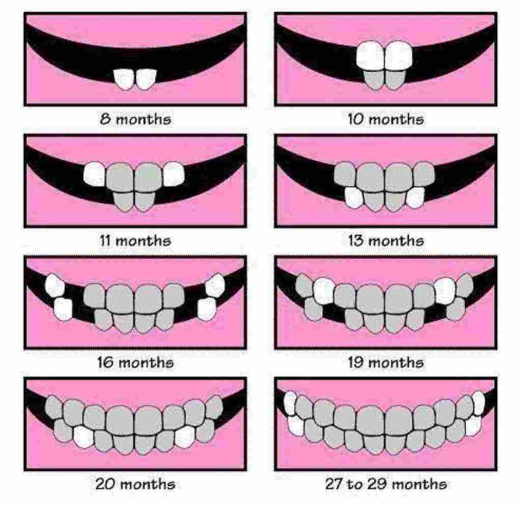 ترتيب ظهور الأسنان عند الأطفال