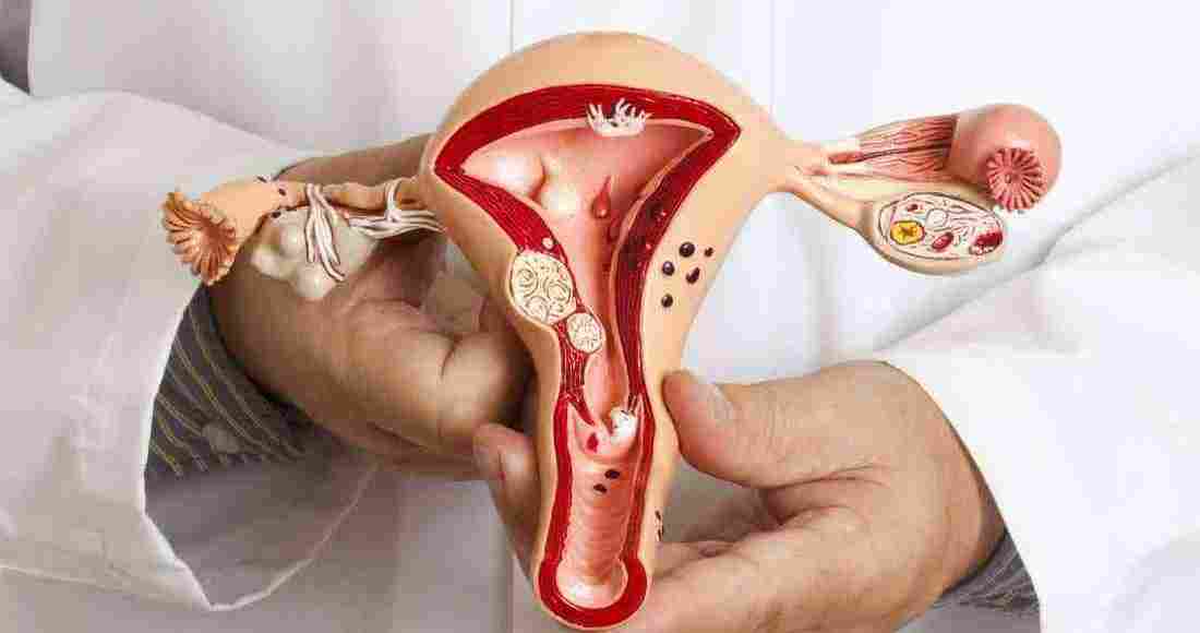 علاج فطريات المهبل بالملح