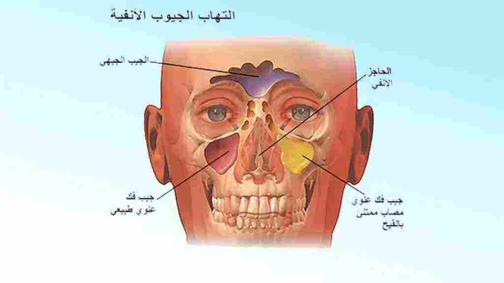 ما هي الجيوب الانفية