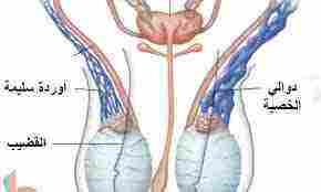 علاج دوالي الخصيتين