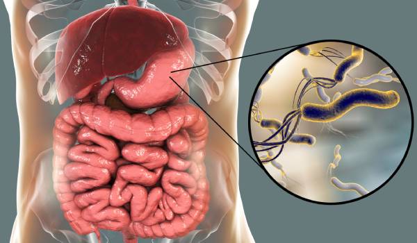 علاج جرثومة المعدة بالأدوية