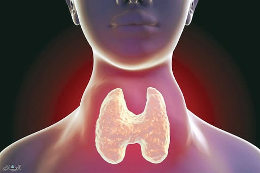 علاج سرطان الغدة الدرقية باليود المشع