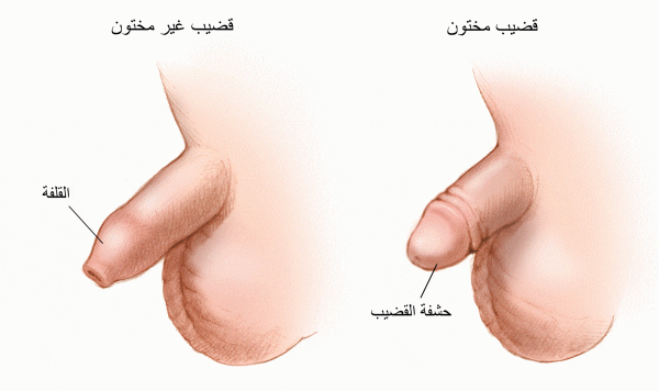 مراحل شفاء الختان بالصور