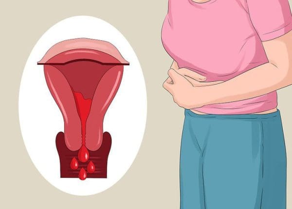 كيف تجعلين الدورة الشهرية تأتي لأول مرة