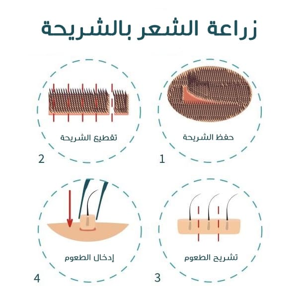 منع تساقط الشعر وتكثيفه للرجال