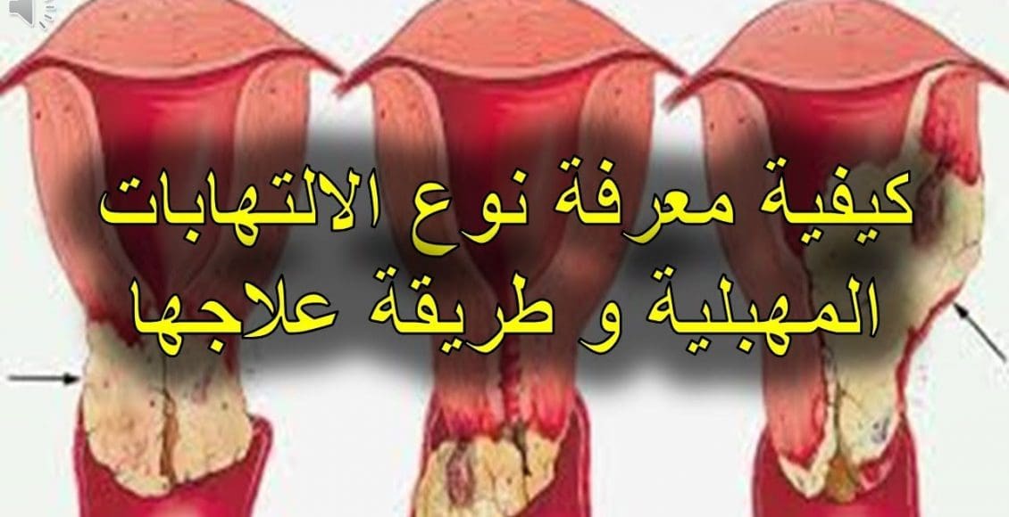 هل رائحة المهبل الكريهة تمنع الحمل