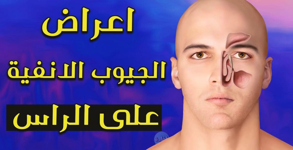 أعراض الجيوب الأنفية على الرأس