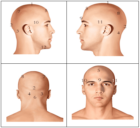 أماكن الحجامة في الرأس بالصور