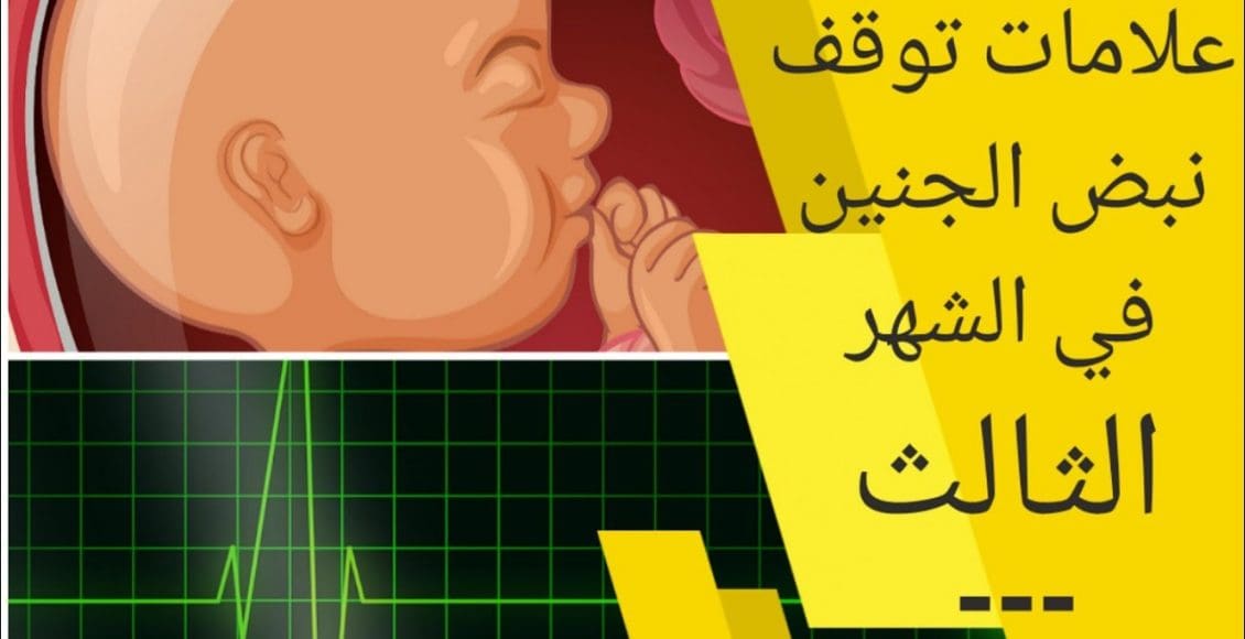 تأخر نبض الجنين إلى الشهر الثالث