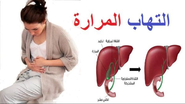 المشروبات الممنوعة لمرضى المرارة