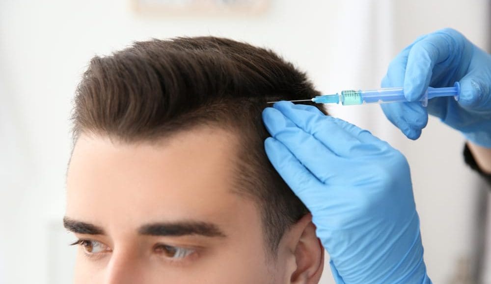 تجربتي مع زراعة الشعر في الرياض