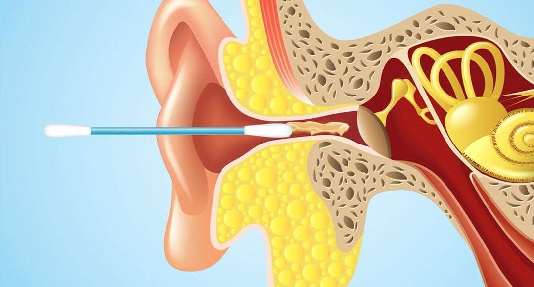 علاج انسداد الأذن في المنزل