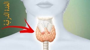 أعراض الغدة الدرقية الخاملة والنشطة وعلاجها