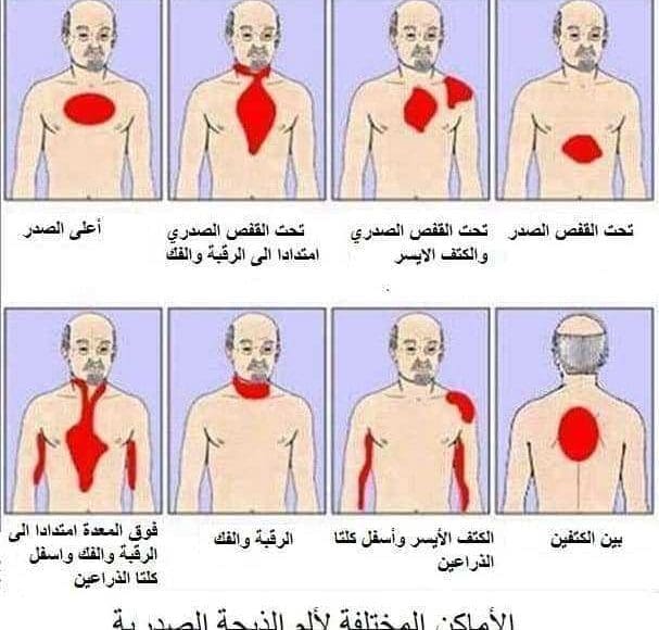 الفرق بين الحموضة والذبحة الصدرية