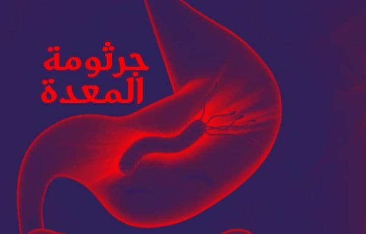 كم يستمر علاج جرثومة المعدة