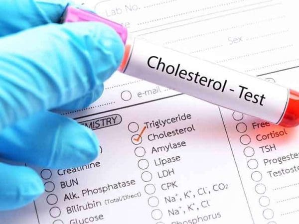 ما هو تحليل LDL cholesterol فحص الكوليسترول الضار