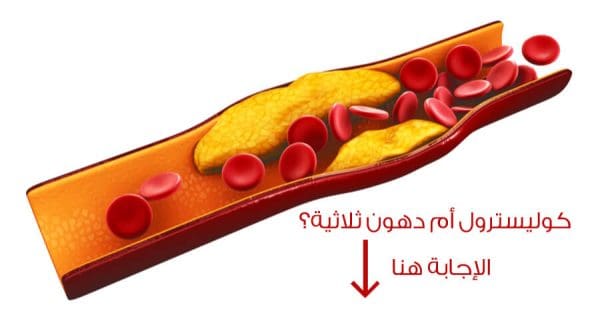 الفرق بين الكولسترول والدهون الثلاثية