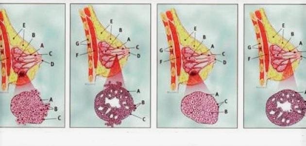 ما هي علامات سرطان الثدي