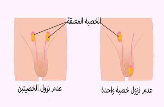 الشكل الطبيعي للعضو الذكري للطفل