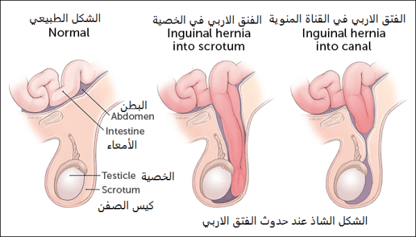 الشكل الطبيعي للعضو الذكري للطفل