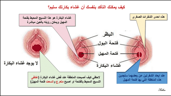 الفرق بين البنت المفتوحة وغير المفتوحة