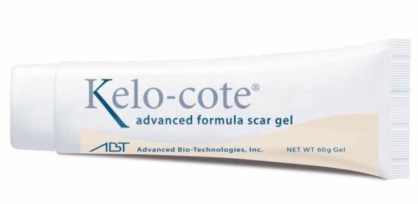 تجربتي مع كريم kelo cote scar gel